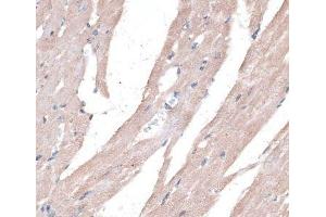 Immunohistochemistry of paraffin-embedded Mouse heart using PPT2 Polyclonal Antibody at dilution of 1:100 (40x lens). (PPT2 anticorps)