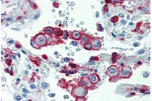 Lung, Human: Formalin-Fixed, Paraffin-Embedded (FFPE)