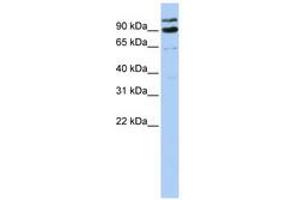 Image no. 1 for anti-LON Peptidase N-terminal Domain and Ring Finger 3 (LONRF3) (AA 612-661) antibody (ABIN6740816) (LONRF3 anticorps  (AA 612-661))
