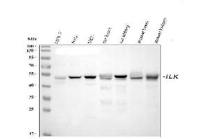 Western blot analysis of Integrin linked ILK using anti-Integrin linked ILK antibody (ABIN7599410).