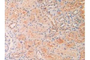 IHC-P analysis of Human Kidney Tissue, with DAB staining. (OIT3 anticorps  (AA 297-506))