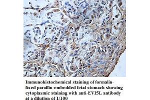 Image no. 1 for anti-Ecotropic Viral Integration Site 5-Like (EVI5L) antibody (ABIN1576395) (EVI5L anticorps)