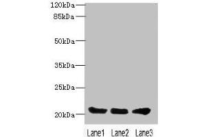 Western blot All lanes: PLLP antibody at 4 μg/mL Lane 1: Mouse gonadal tissue Lane 2: Mouse kidney tissue Lane 3: Mouse lung tissue Secondary Goat polyclonal to rabbit IgG at 1/10000 dilution Predicted band size: 20 kDa Observed band size: 20 kDa