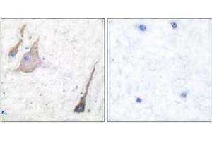 Immunohistochemistry analysis of paraffin-embedded human brain tissue, using Synuclein-pan Antibody. (Synuclein anticorps  (AA 15-64))