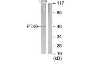 Western blot analysis of extracts from LOVO cells, using Breast Tumor Kinase Antibody. (PTK6 anticorps  (AA 10-59))