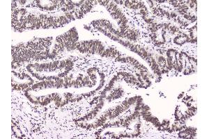IHC analysis of RbAp48 using anti-RbAp48 antibody (ABIN5692929). (Retinoblastoma Binding Protein 4 anticorps  (C-Term))