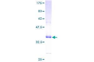 Image no. 1 for Defensin, alpha 1 (DEFA1) (AA 1-94) protein (GST tag) (ABIN1351408)