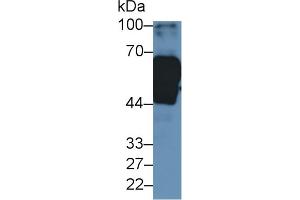 Detection of HMWK in Human Urine using Polyclonal Antibody to High Molecular Weight Kininogen (HMWK)