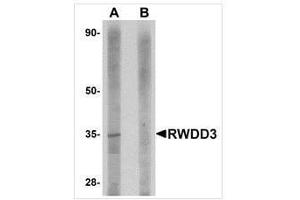 Western blot analysis of RWDD3 in rat kidney tissue lysate with RWDD3 antibody at 1 μg/ml in (A) the absence and (B) the presence of blocking peptide. (RWDD3 anticorps  (C-Term))