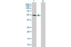Western Blot analysis of SOCS5 expression in transfected 293T cell line by SOCS5 MaxPab polyclonal antibody. (SOCS5 anticorps  (AA 1-536))
