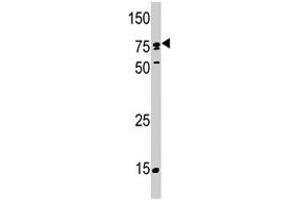 Western blot analysis of SCYL2 polyclonal antibody  in T-47D . (SCYL2 anticorps  (C-Term))