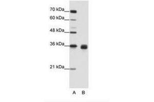 Image no. 2 for anti-Wingless-Type MMTV Integration Site Family, Member 2B (WNT2B) (AA 229-278) antibody (ABIN203089)