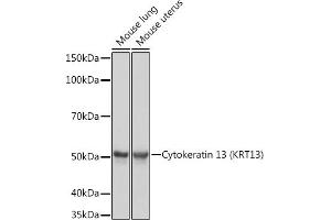 Western blot analysis of extracts of various cell lines, using Cytokeratin 13 (KRT13) (KRT13) Rabbit mAb (ABIN7268089) at 1:1000 dilution. (Cytokeratin 13 anticorps)