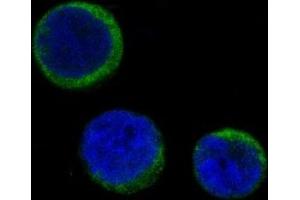 Immunofluorescent analysis of Jurkat cells, using Ferritin Antibody.