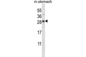 Western Blotting (WB) image for anti-Dolichyl Pyrophosphate Phosphatase 1 (DOLPP1) antibody (ABIN2997455) (DOLPP1 anticorps)