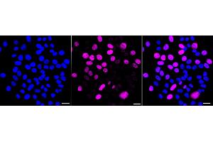 Immunocytochemical staining of HepG2 cells with Kinesin family member C1 antibody (ABIN7799209), 1:).