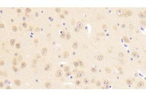 Detection of PCDHb2 in Mouse Cerebrum Tissue using Polyclonal Antibody to Protocadherin Beta 2 (PCDHb2)