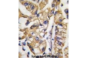 Immunohistochemistry (IHC) image for anti-SLC2A4 Regulator (SLC2A4RG) antibody (ABIN2997830)