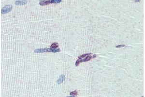 Human Skeletal Muscle: Formalin-Fixed, Paraffin-Embedded (FFPE)