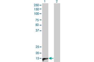Western Blot analysis of CALCA expression in transfected 293T cell line by CALCA monoclonal antibody (M01), clone 4B10. (CGRP anticorps  (AA 52-141))
