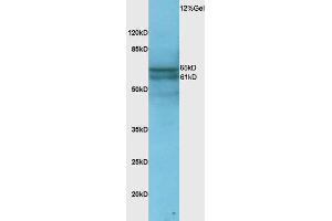 Rat lung lysate probed with Anti Phospho-NFKB p65(Ser276) Polyclonal Antibody, Unconjugated  at 1:3000 for 90 min at 37˚C. (NF-kB p65 anticorps  (pSer276))