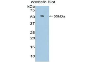 Western blot analysis of the recombinant protein. (KIF5A anticorps  (AA 823-1027))