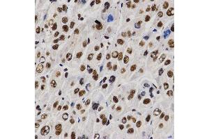 Immunohistochemistry (IHC) image for anti-Proline-, Glutamic Acid- and Leucine-Rich Protein 1 (PELP1) (AA 1021-1180) antibody (ABIN3023502) (PELP1 anticorps  (AA 1021-1180))