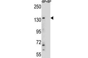Western blot analysis of JMJD3 antibody and HeLa lysate
