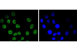 HepG2 cells were stained with Cyclin E1 (4H7) Monoclonal Antibody  at [1:200] incubated overnight at 4C, followed by secondary antibody incubation, DAPI staining of the nuclei and detection. (Cyclin E1 anticorps)