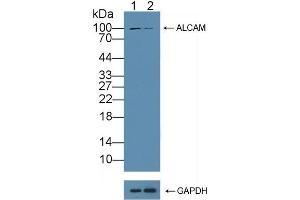 Knockout Varification: Lane 1: Wild-type HT1080 cell lysate, Lane 2: ALCAM knockout HT1080 cell lysate, Predicted MW: 65kd Observed MW: 100kd Primary Ab: 3 μg/mL Rabbit Anti-Mouse ALCAM Antibody Second Ab: 0.