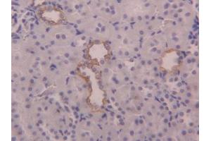IHC-P analysis of Rat Kidney Tissue, with DAB staining. (KRT6A anticorps  (AA 323-461))