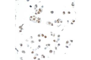 Immunocytochemistry (ICC) image for anti-Cyclin-Dependent Kinase 7 (CDK7) (AA 300-346) antibody (ABIN7454008) (Recombinant CDK7 anticorps  (AA 300-346))