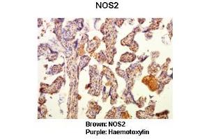 Sample Type: Human placental tissue  Primary Antibody Dilution: 1:50Secondary Antibody: Goat anti rabbit-HRP  Secondary Antibody Dilution: 1:00,000Color/Signal Descriptions: Brown: NOS2Purple: Haemotoxylin  Gene Name: NOS2 Submitted by: Dr.