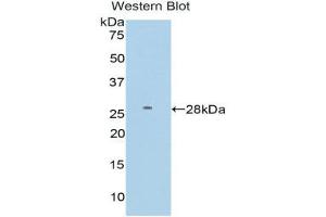 Western Blotting (WB) image for anti-Farnesyl-Diphosphate Farnesyltransferase 1 (FDFT1) (AA 187-416) antibody (ABIN3206186) (FDFT1 anticorps  (AA 187-416))