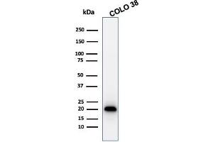 Western Blot Analysis of COLO 38 cell lysate using MART-1 Rabbit Recombinant Monoclonal Antibody (MLANA/1761R). (Recombinant MLANA anticorps)
