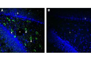 Expression of SARM1 in rat hippocampusImmunohistochemical staining of perfusion-fixed frozen rat brain sections using Anti-SARM1 Antibody (ABIN7581954), (1:300), followed by goat anti-rabbit-AlexaFluor-488.
