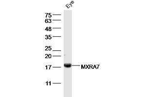 Mouse eye lysates probed with MXRA7 Polyclonal Antibody, Unconjugated  at 1:300 dilution and 4˚C overnight incubation. (MXRA7 anticorps  (AA 121-204))