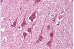 Human Brain, Cortex (formalin-fixed, paraffin-embedded) stained with MRE11A antibody ABIN214028 at 5 ug/ml followed by biotinylated goat anti-rabbit IgG secondary antibody ABIN481713, alkaline phosphatase-streptavidin and chromogen. (Mre11 anticorps  (AA 68-706))