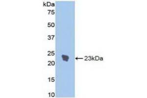 Detection of Recombinant IL1R1, Rat using Polyclonal Antibody to Interleukin 1 Receptor Type I (IL1R1)