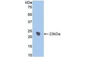 Detection of Recombinant IL1R1, Rat using Polyclonal Antibody to Interleukin 1 Receptor Type I (IL1R1) (IL1R1 anticorps  (AA 386-553))