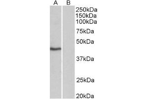 Image no. 1 for anti-TATA Box Binding Protein (TBP) (AA 2-12) antibody (ABIN1104605) (TBP anticorps  (AA 2-12))
