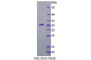 SDS-PAGE analysis of Mouse TPT1 Protein. (TPT1 Protéine)