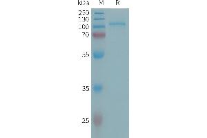 Ectonucleotide Pyrophosphatase / phosphodiesterase 2 (ENPP2) (AA 49-863) protein (His tag)