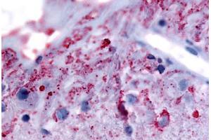 Human Eye, Ganglion Cells (formalin-fixed, paraffin-embedded) stained with GRM6 antibody ABIN213492 at 5.