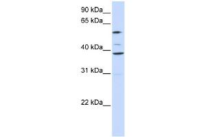 WB Suggested Anti-SLC25A16 Antibody Titration:  0. (SLC25A16 anticorps  (Middle Region))