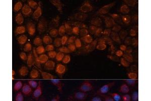 Immunofluorescence analysis of HeLa cells using SLC25A24 Polyclonal Antibody at dilution of 1:100.