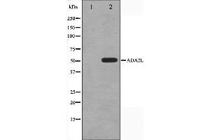 Western blot analysis on COLO205 cell lysate using ADA2L Antibody,The lane on the left is treated with the antigen-specific peptide. (TADA2L anticorps)
