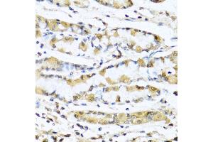 Immunohistochemistry of paraffin-embedded human stomach using GNRH1 antibody (ABIN5973277) at dilution of 1/100 (40x lens). (GNRH1 anticorps)