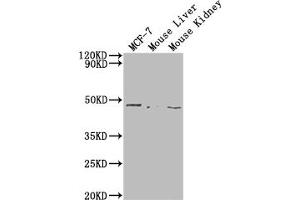 Western Blot Positive WB detected in: MCF-7 whole cell lysate, Mouse Liver tissue, Mouse Kidney tissue All lanes: NRXN1 antibody at 1:2000 Secondary Goat polyclonal to rabbit IgG at 1/50000 dilution Predicted band size: 47 kDa Observed band size: 47 kDa (Neurexin 1 anticorps  (AA 184-363))
