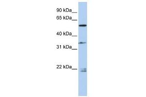 DPYSL2 antibody used at 1 ug/ml to detect target protein.